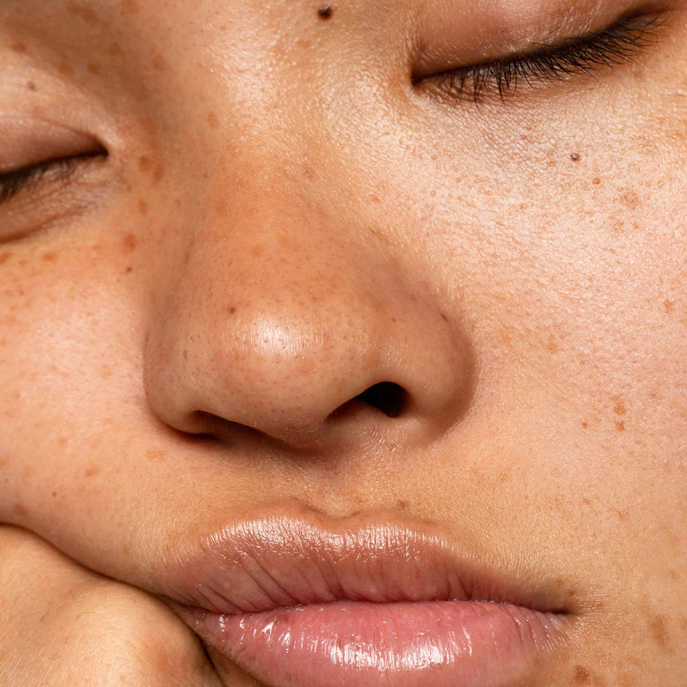 Koreaanse huidverzorging voor de vette huid