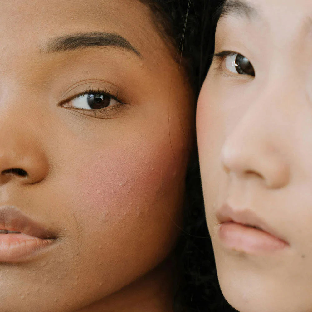 Hoe bepaal je jouw huidtype?